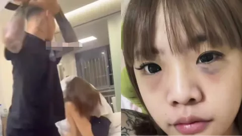 国服玄策皮带哥